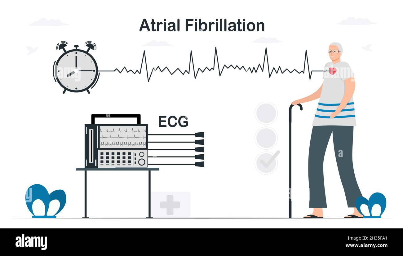 An electrocardiogram was used to analyse for atrial fibrillation problem. Cardiology vector illustration in flat style. Stock Vector