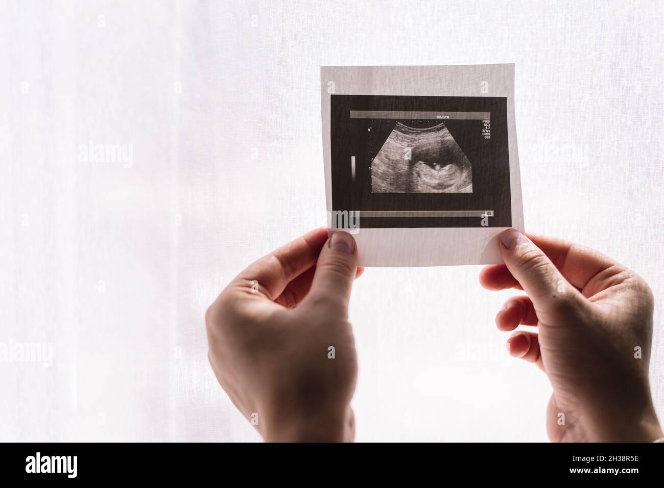 Woman's hands holding an ultrasound of her baby Stock Photo Alamy