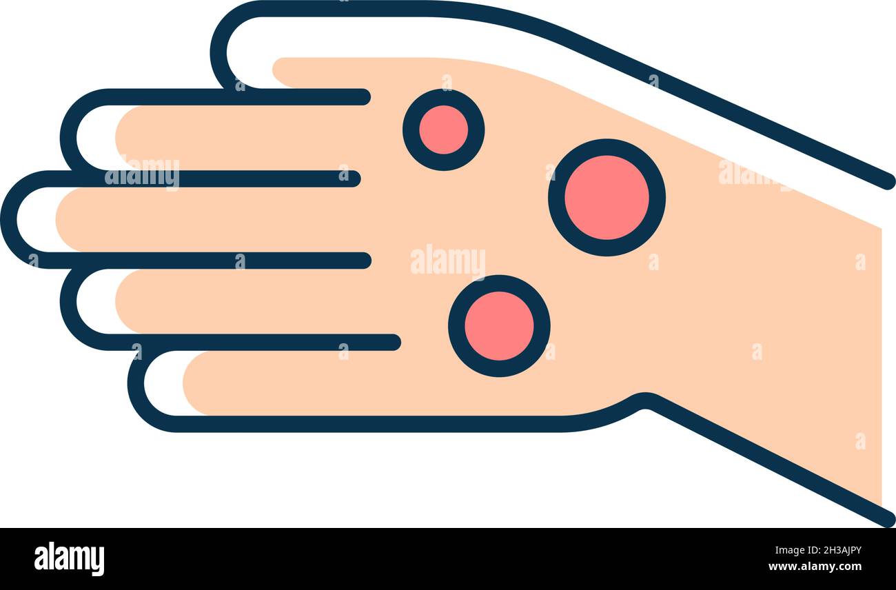 Rheumatoid nodules RGB color icon Stock Vector Image & Art - Alamy