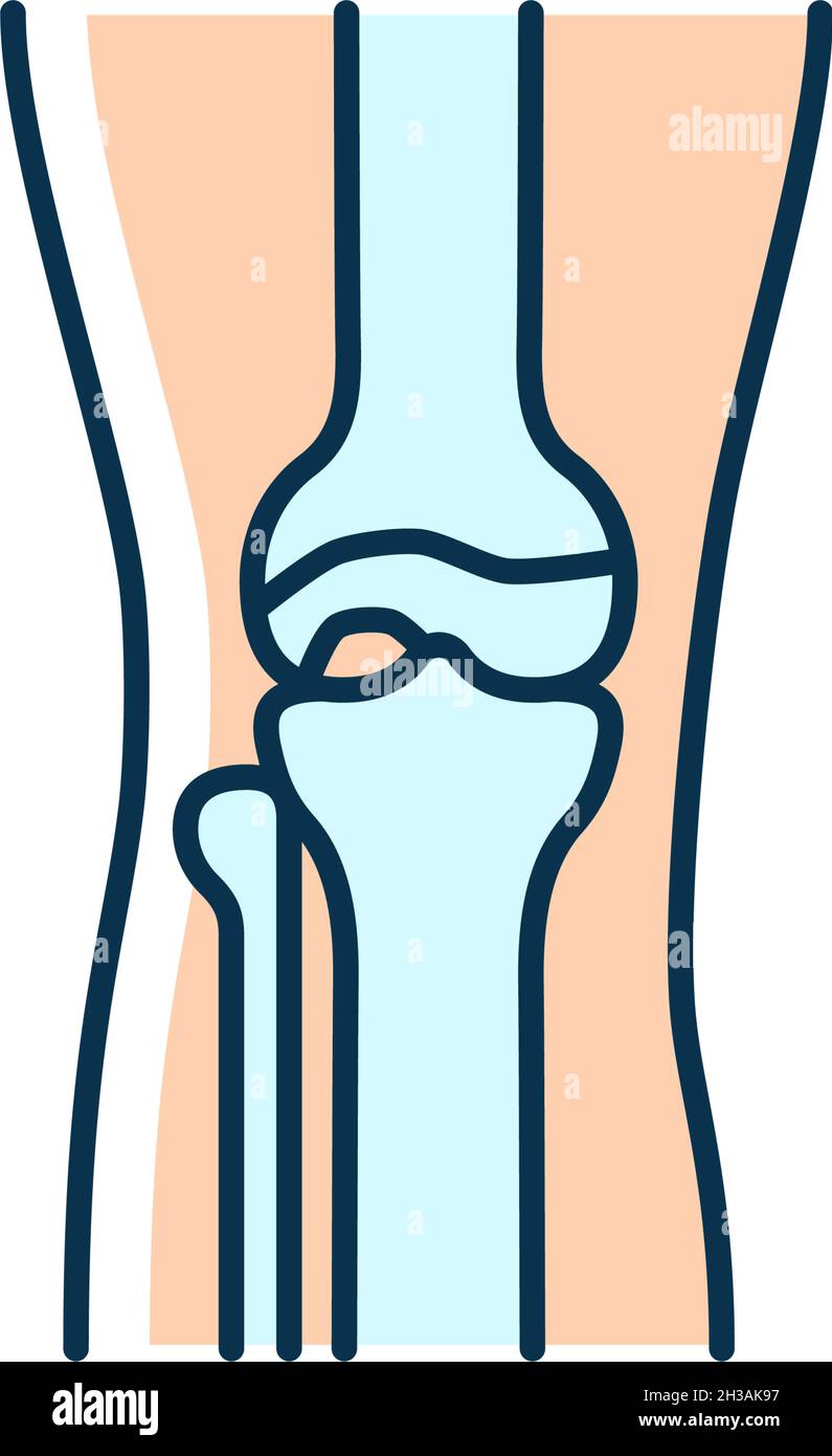 Osteoarthritis RGB color icon Stock Vector