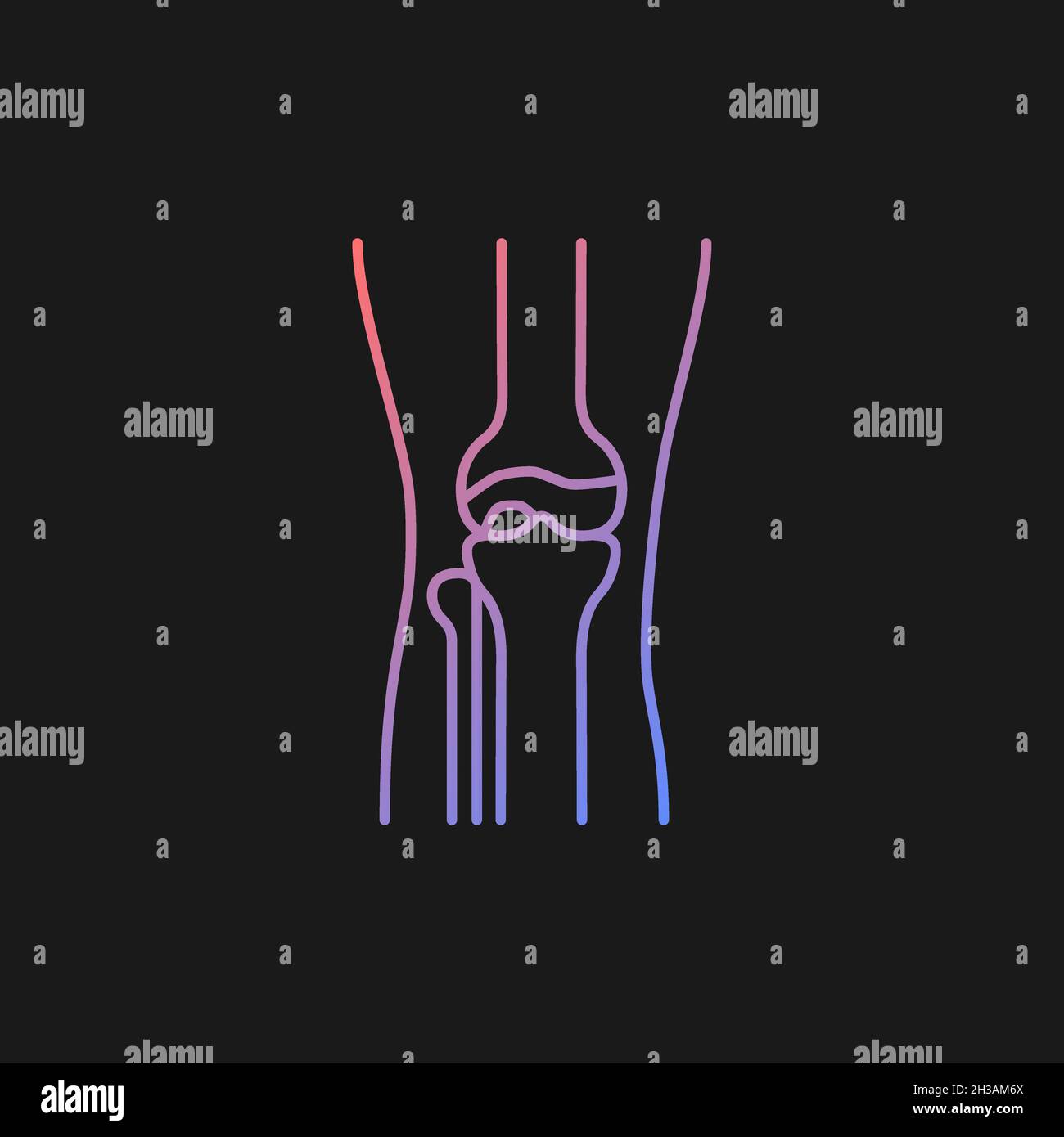 Osteoarthritis gradient vector icon for dark theme Stock Vector