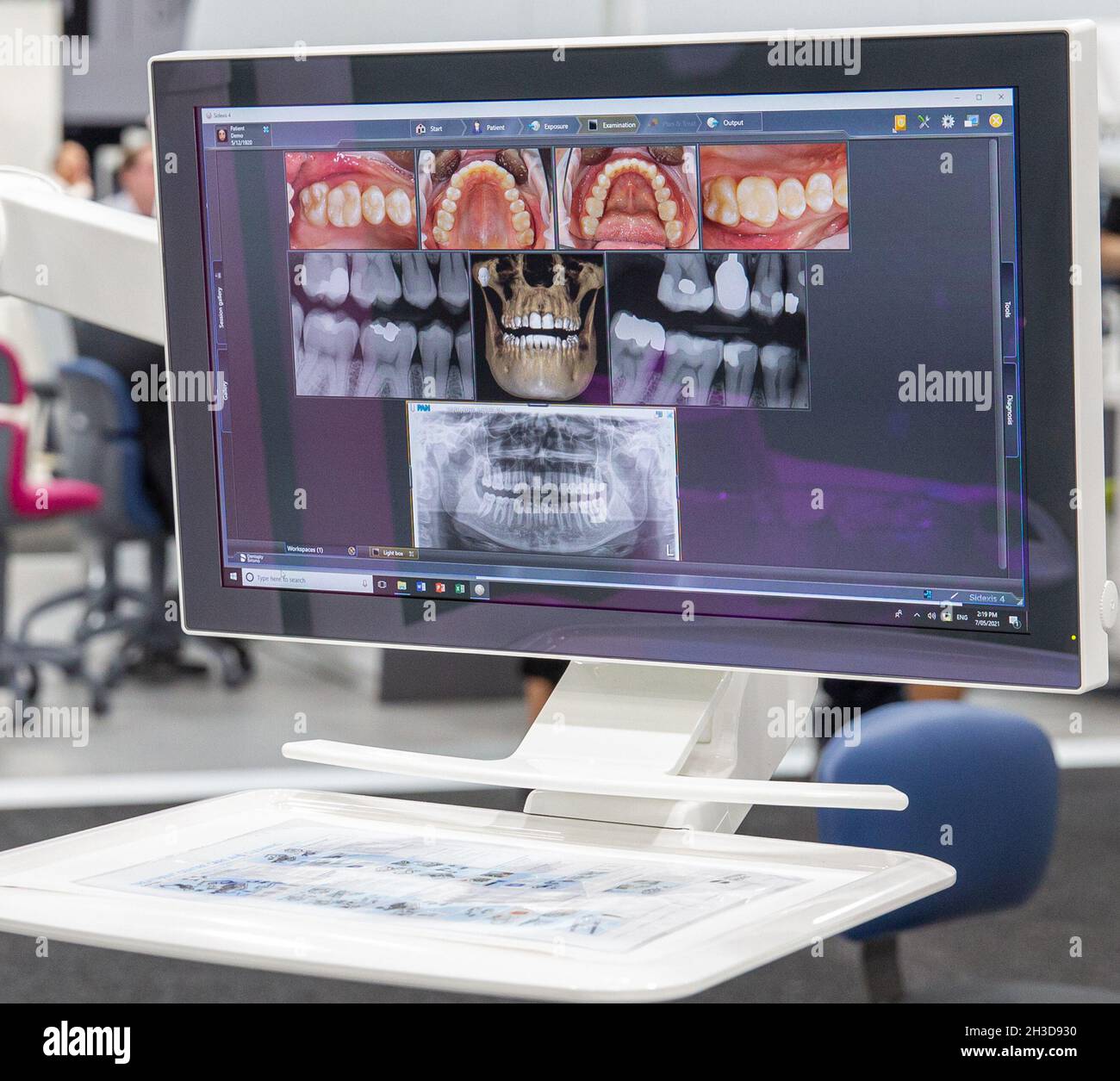 Dental X Rays on a monitor at a dental exhibition Stock Photo Alamy