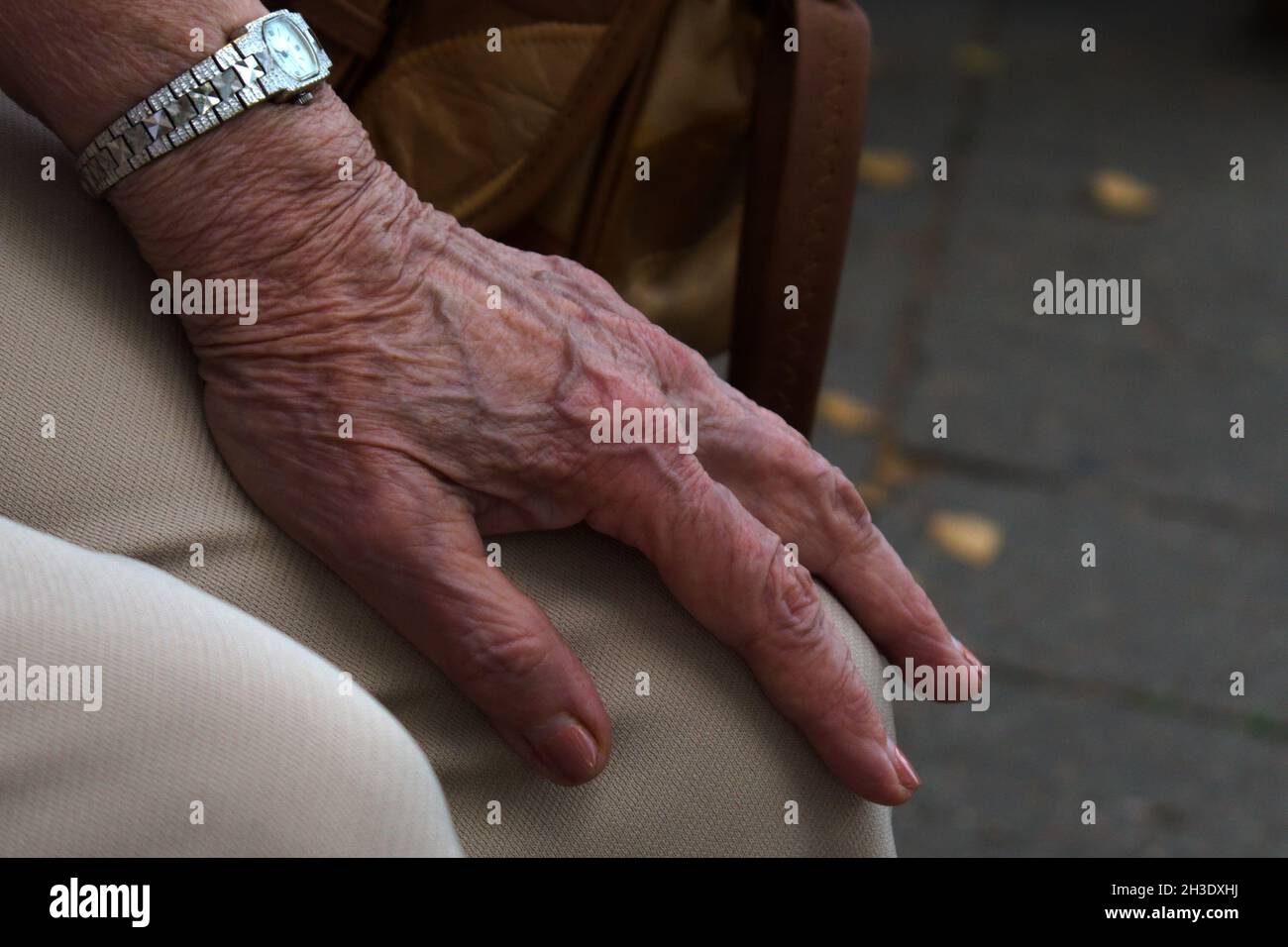 elderly woman hand with a watch on her knee Stock Photo