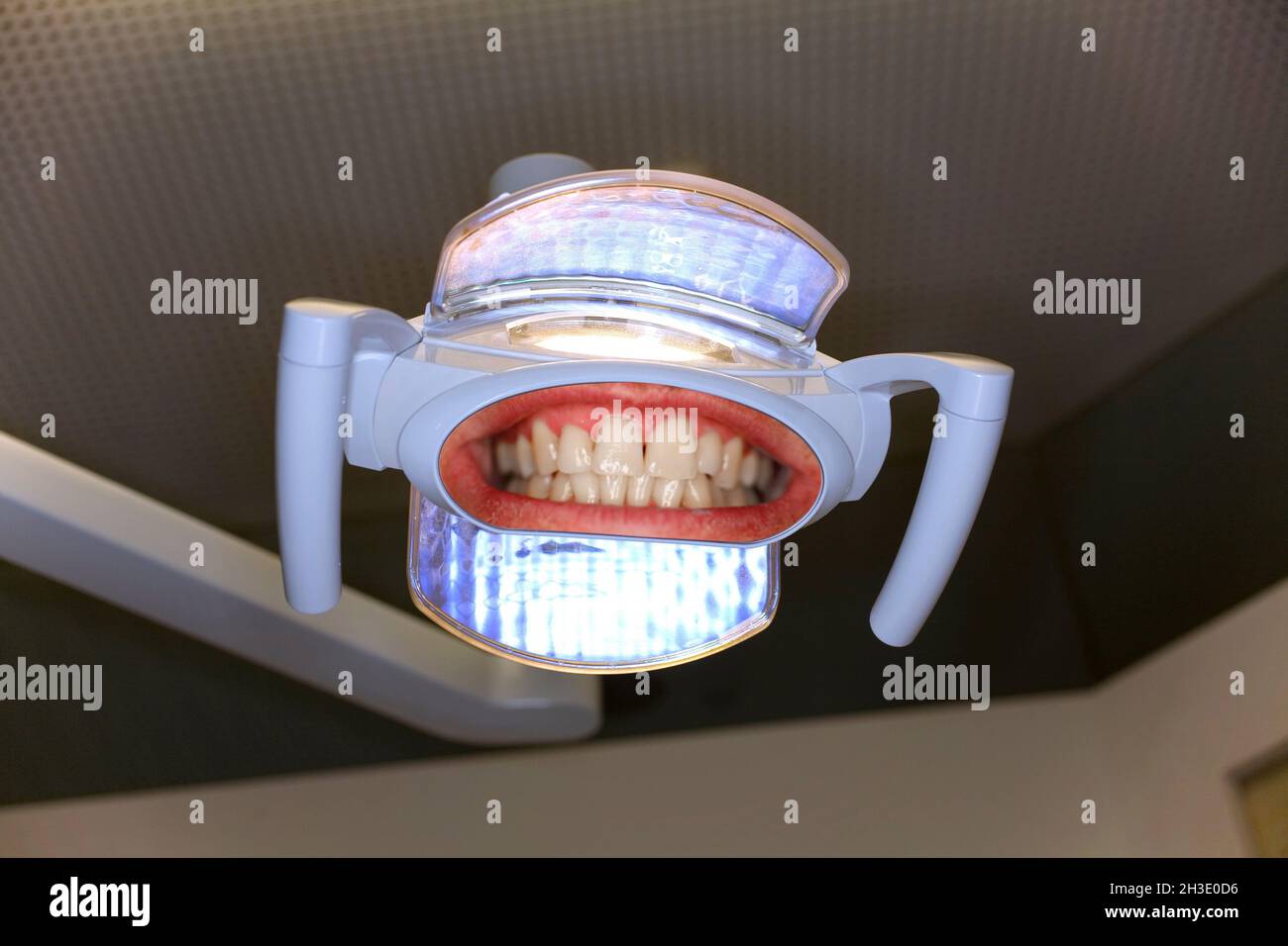 mouth reflecting in Dentist lamp, composing Stock Photo