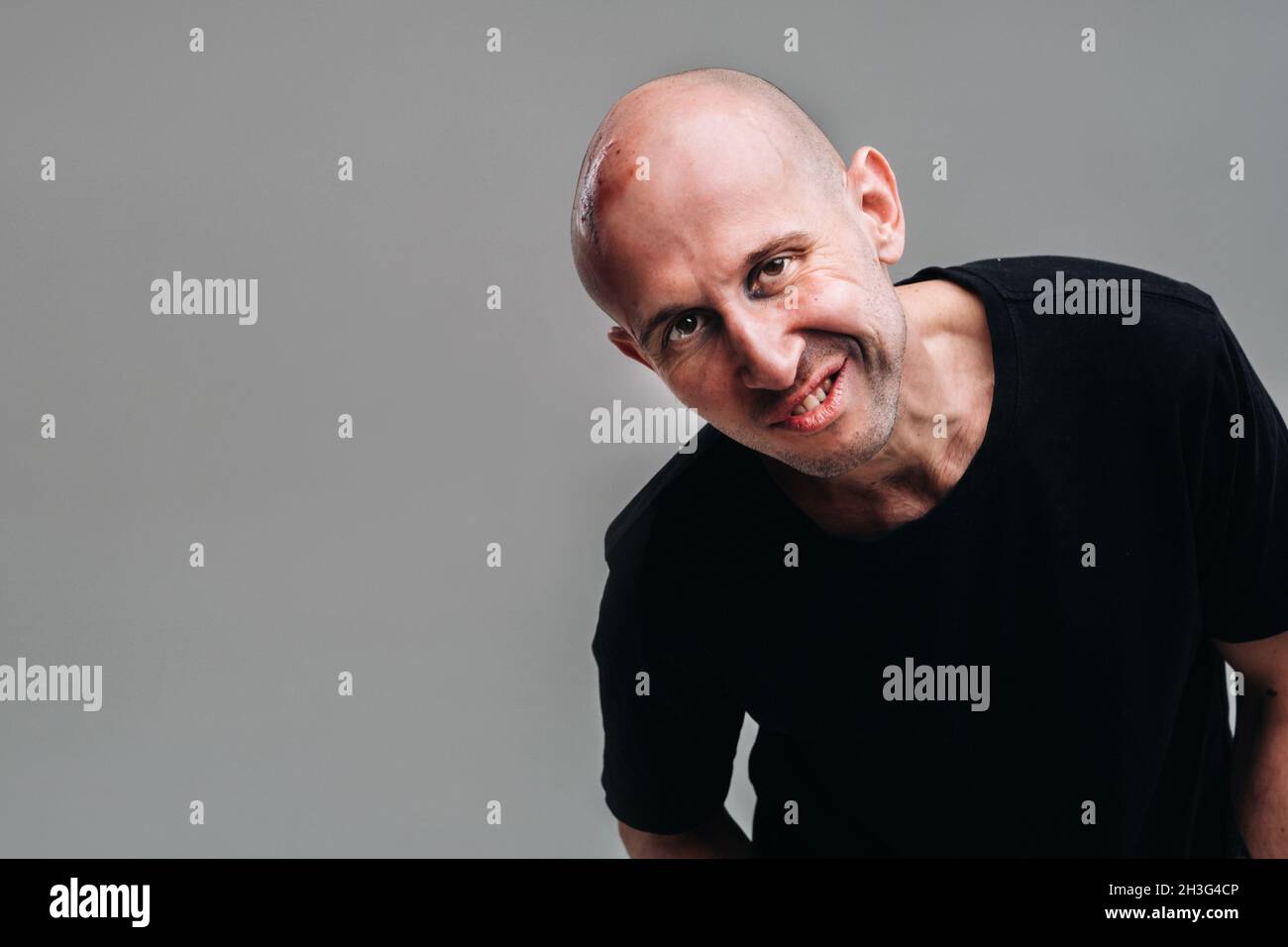 A battered man in a black T shirt who looks like a drug addict and a drunkard stands on a gray background. Stock Photo