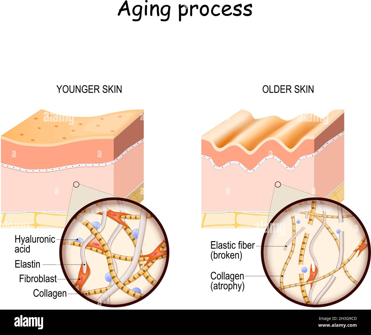 Aging process. comparison and difference between younger and older skin. Layers of the skin and close up of elastin, collagen fibers, hyaluronic acid Stock Vector