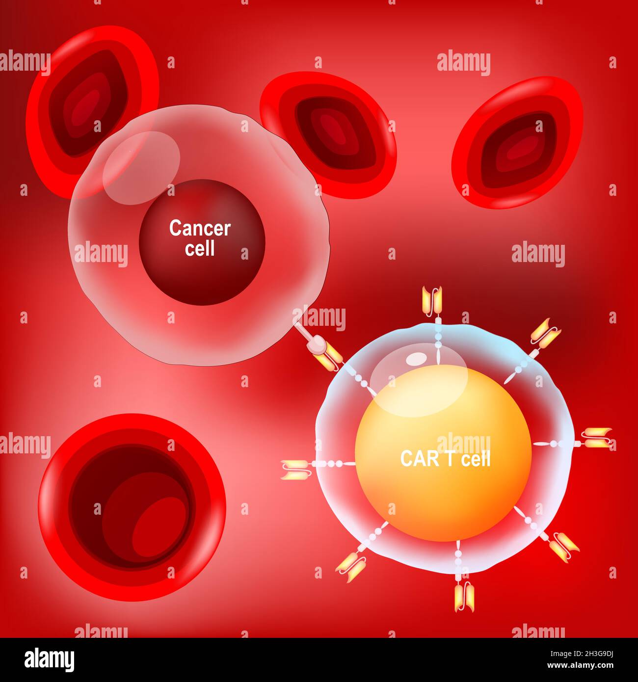 Cancer cell, CAR t-cell (lymphocyte) and red blood cells on red background. vector Poster about immunotherapy or chemotherapy cancer. Stock Vector