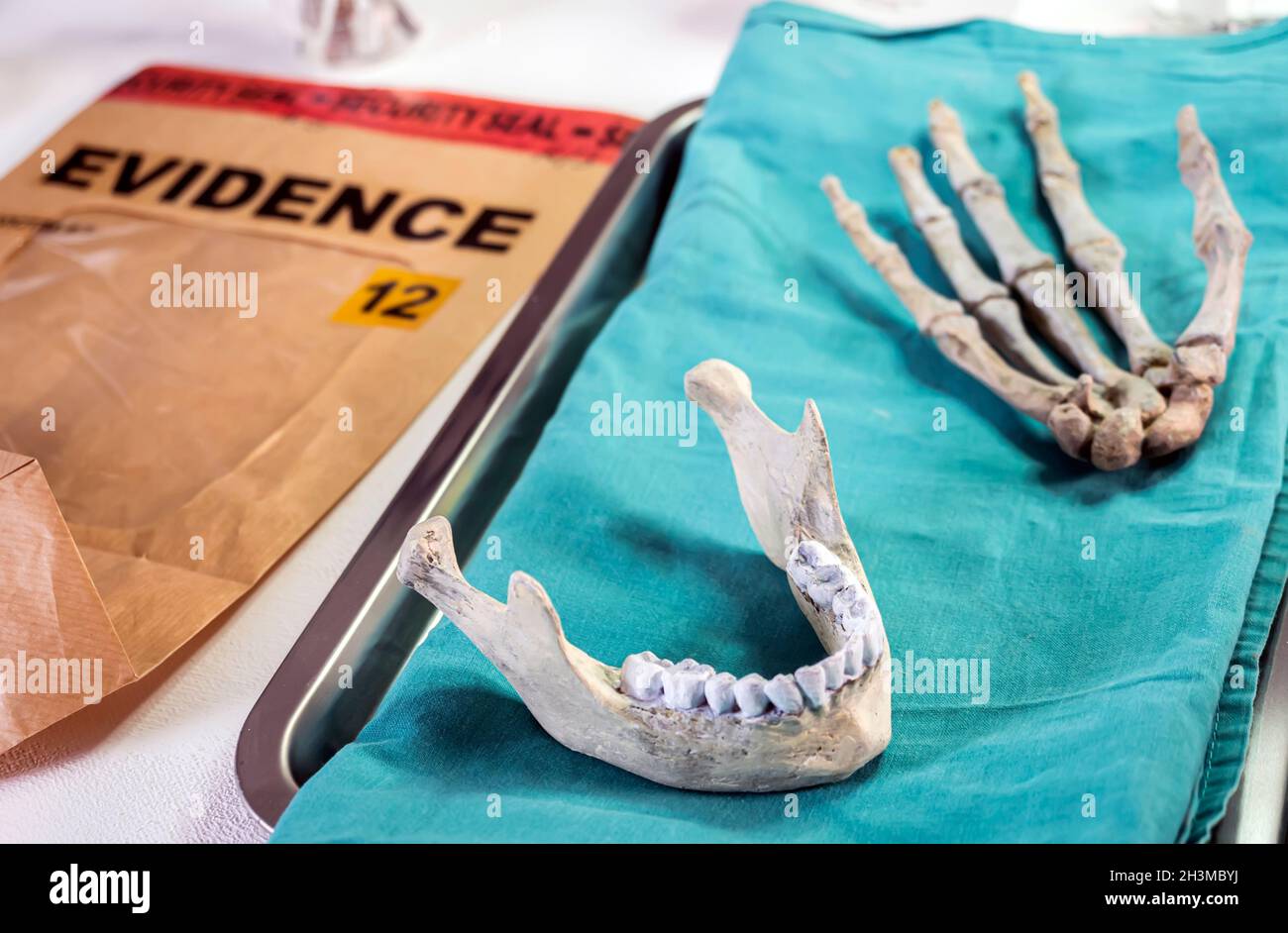 Human lower jaw and right hand in forensic laboratory murder investigation, concept image Stock Photo