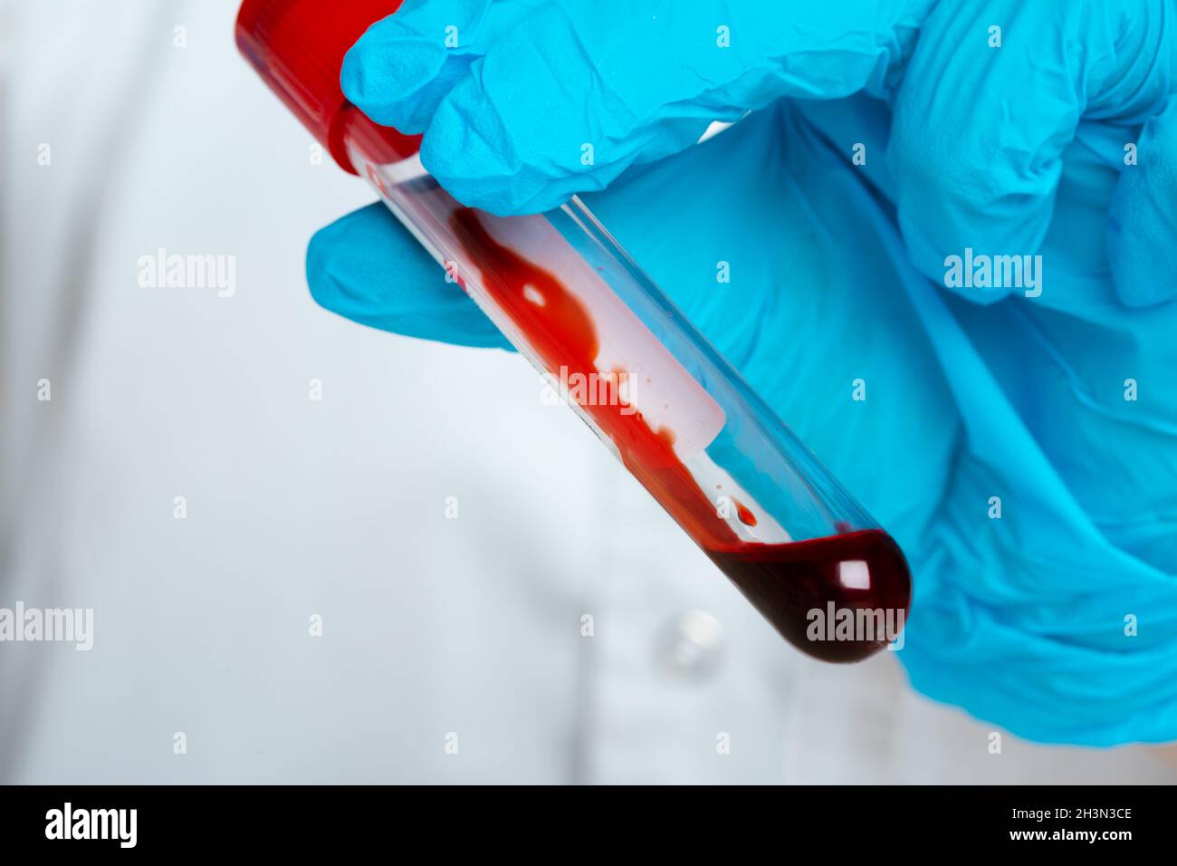 Doctor in blue gloves keep in hands test tube with a blood and syringe Stock Photo