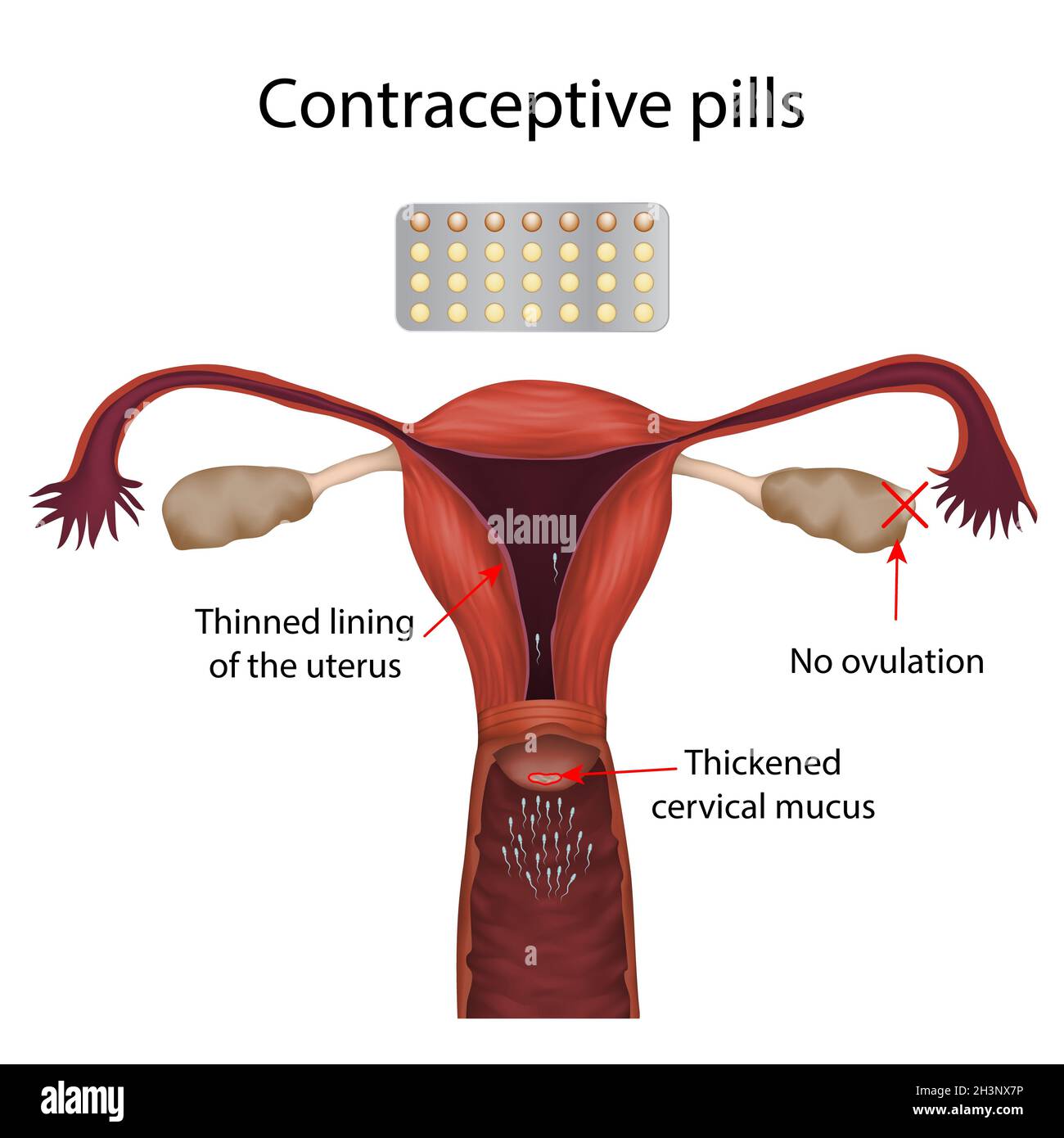 Contraceptive pills, illustration Stock Photo