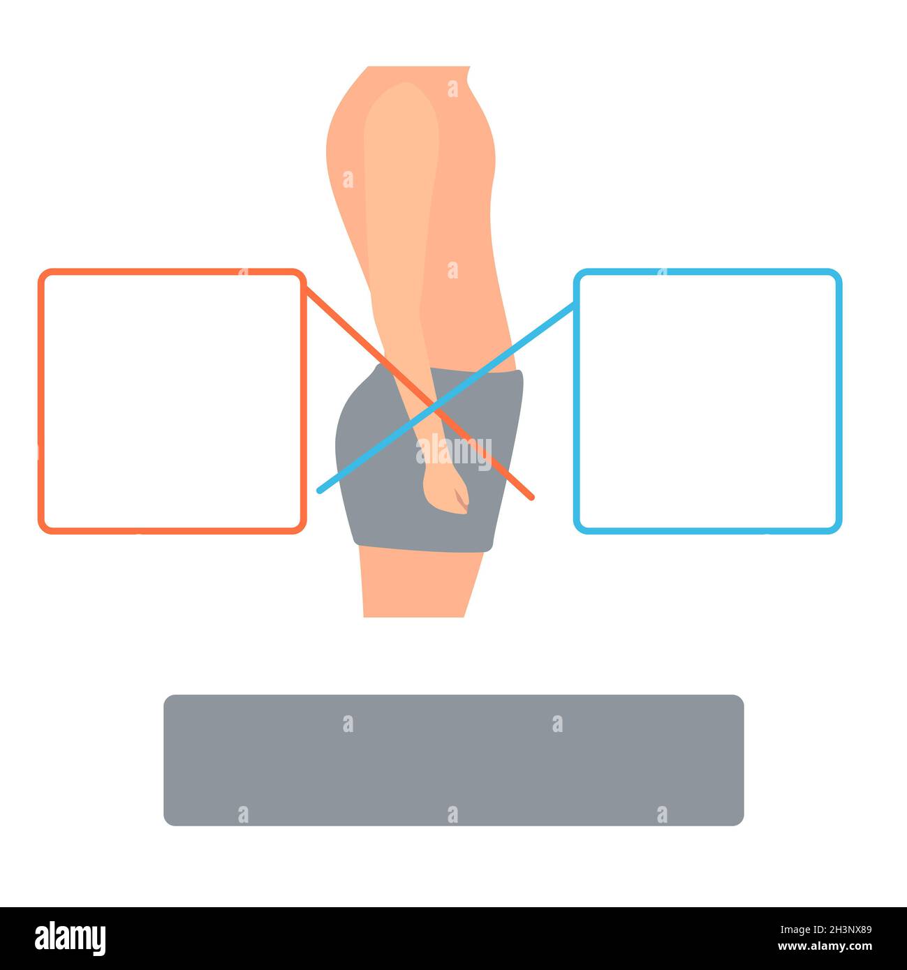 Lower crossed syndrome, conceptual illustration Stock Photo