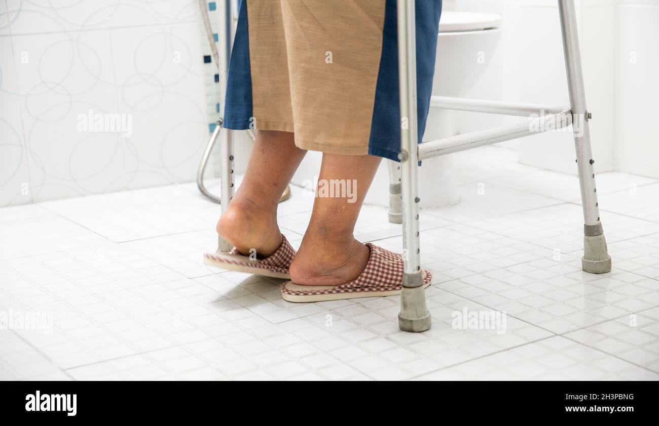 Elderly swollen feet or edema leg walk into bathroom Stock Photo Alamy