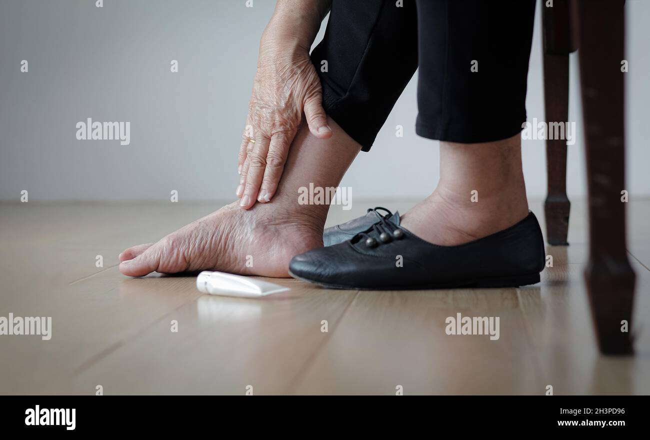 Elderly woman putting cream on swollen feet before put on shoes Stock