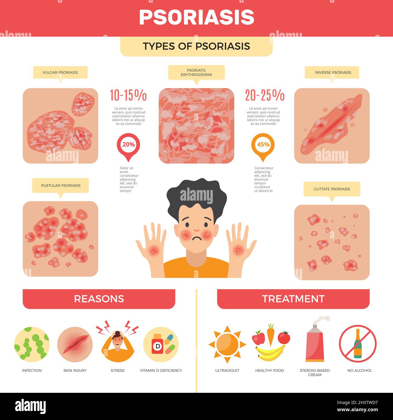Psoriasis infographic. Human skin infection psoriasis diagnosis vector medical pictures Stock Vector