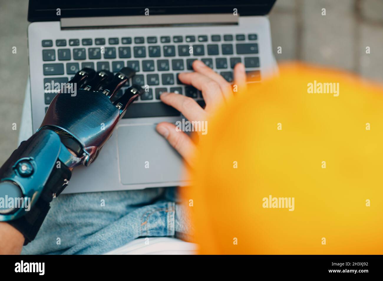 Young disabled man with artificial prosthetic hand using typing on laptop computer keyboard