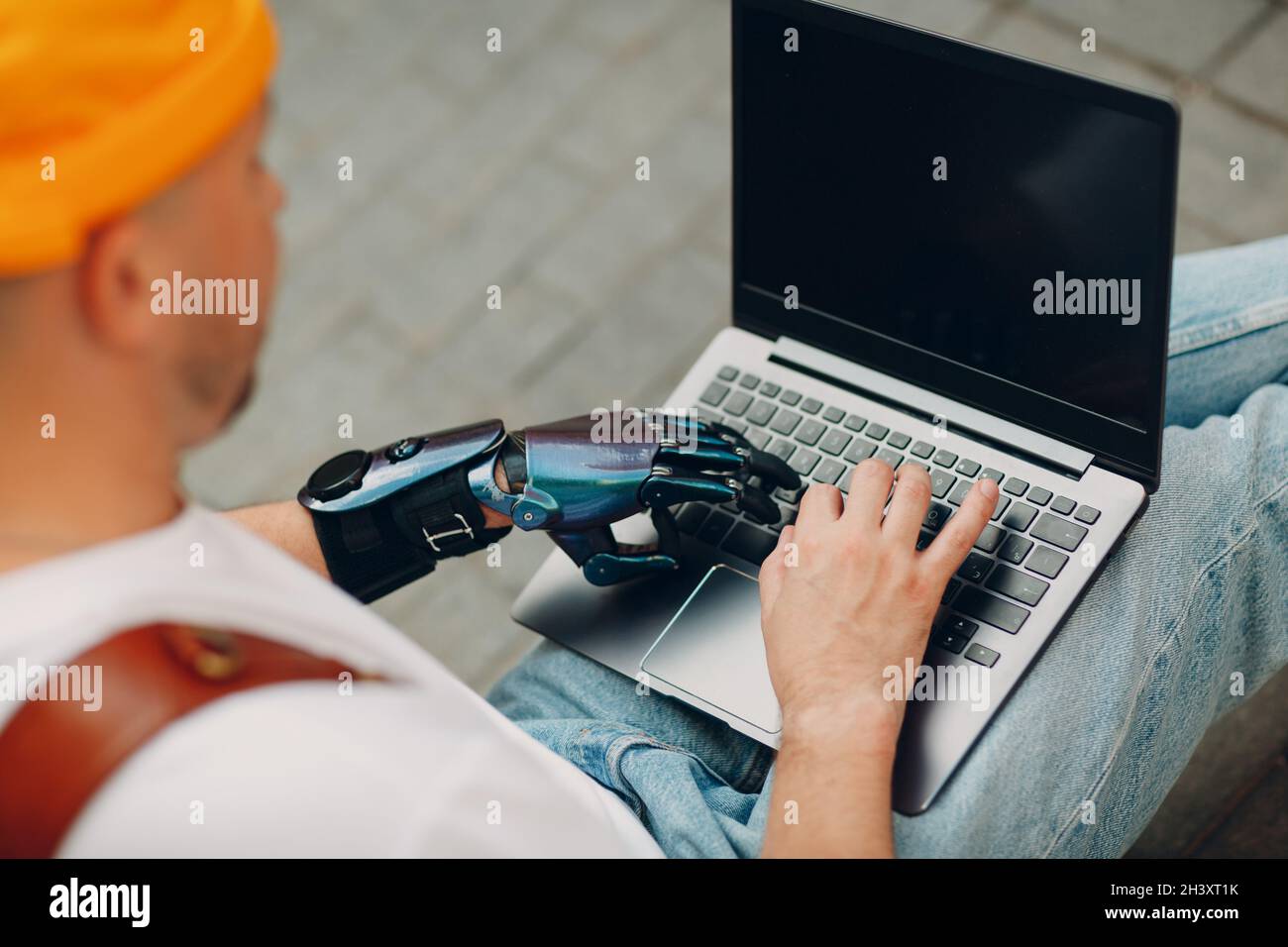 Young disabled man with artificial prosthetic hand using typing on laptop computer keyboard. Stock Photo