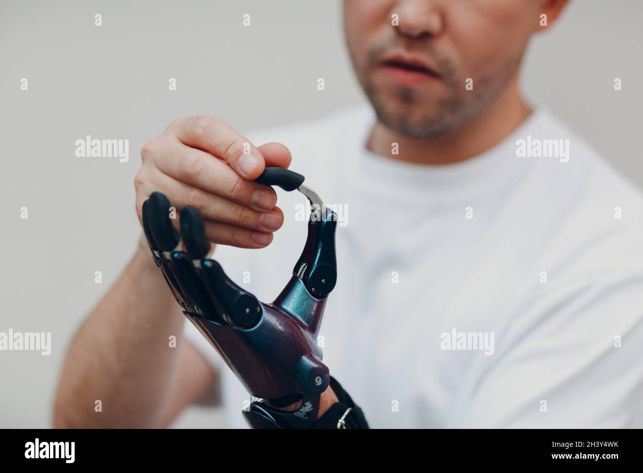 Young disabled man with artificial prosthetic hand put on finger nozzle ...