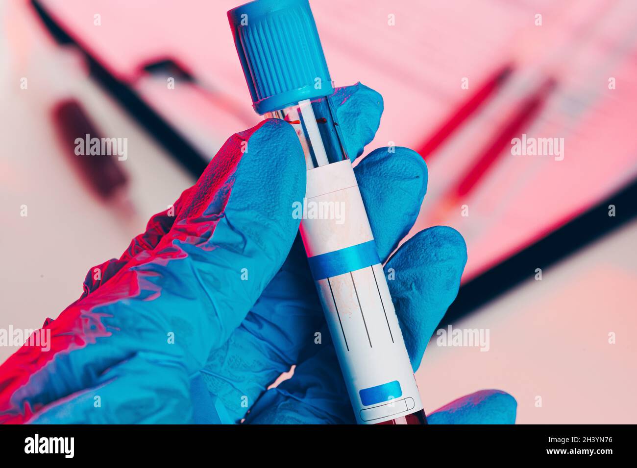 Doctor's hands in blue gloves keep test tube with a blood Stock Photo