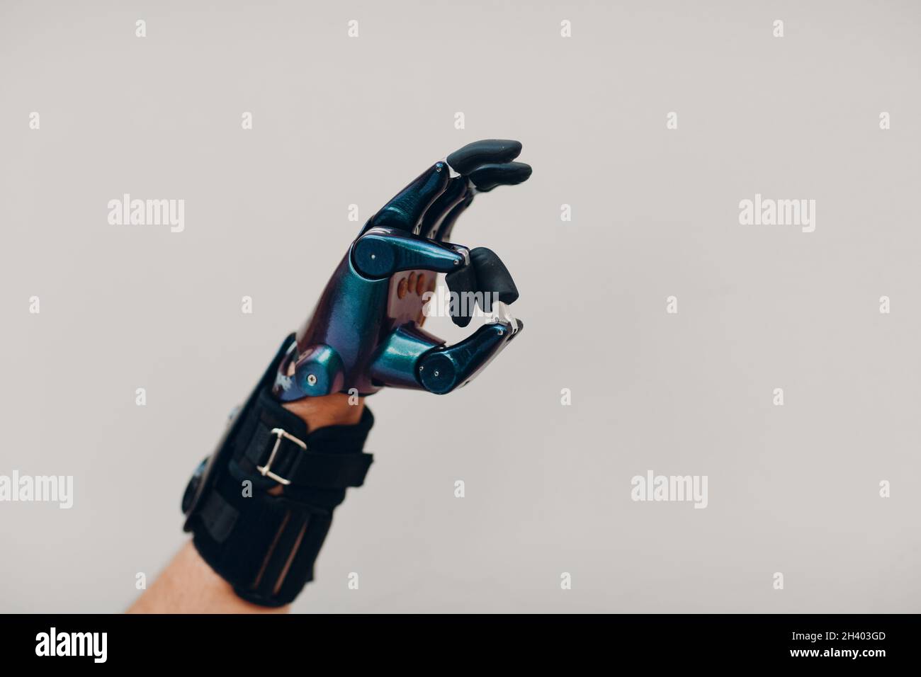 Young disabled man with artificial prosthetic hand in casual clothes. Stock Photo
