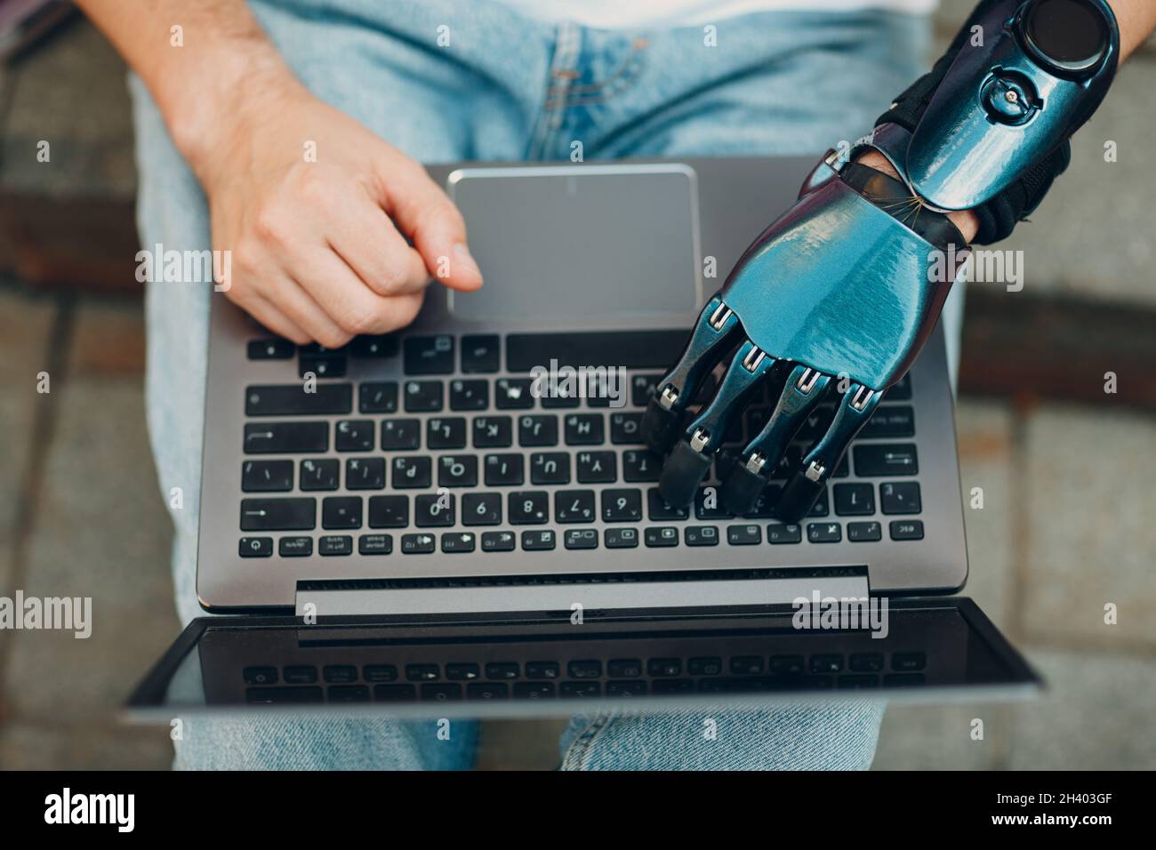 Young disabled man with artificial prosthetic hand using typing on laptop computer keyboard. Stock Photo
