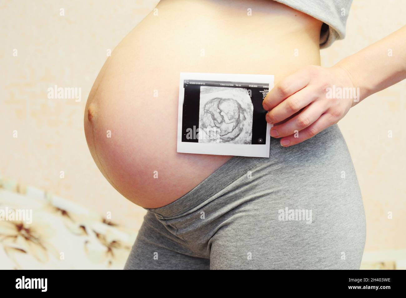 Pregnancy ultrasound scan. Pregnant woman holding ultrasound scan on ...