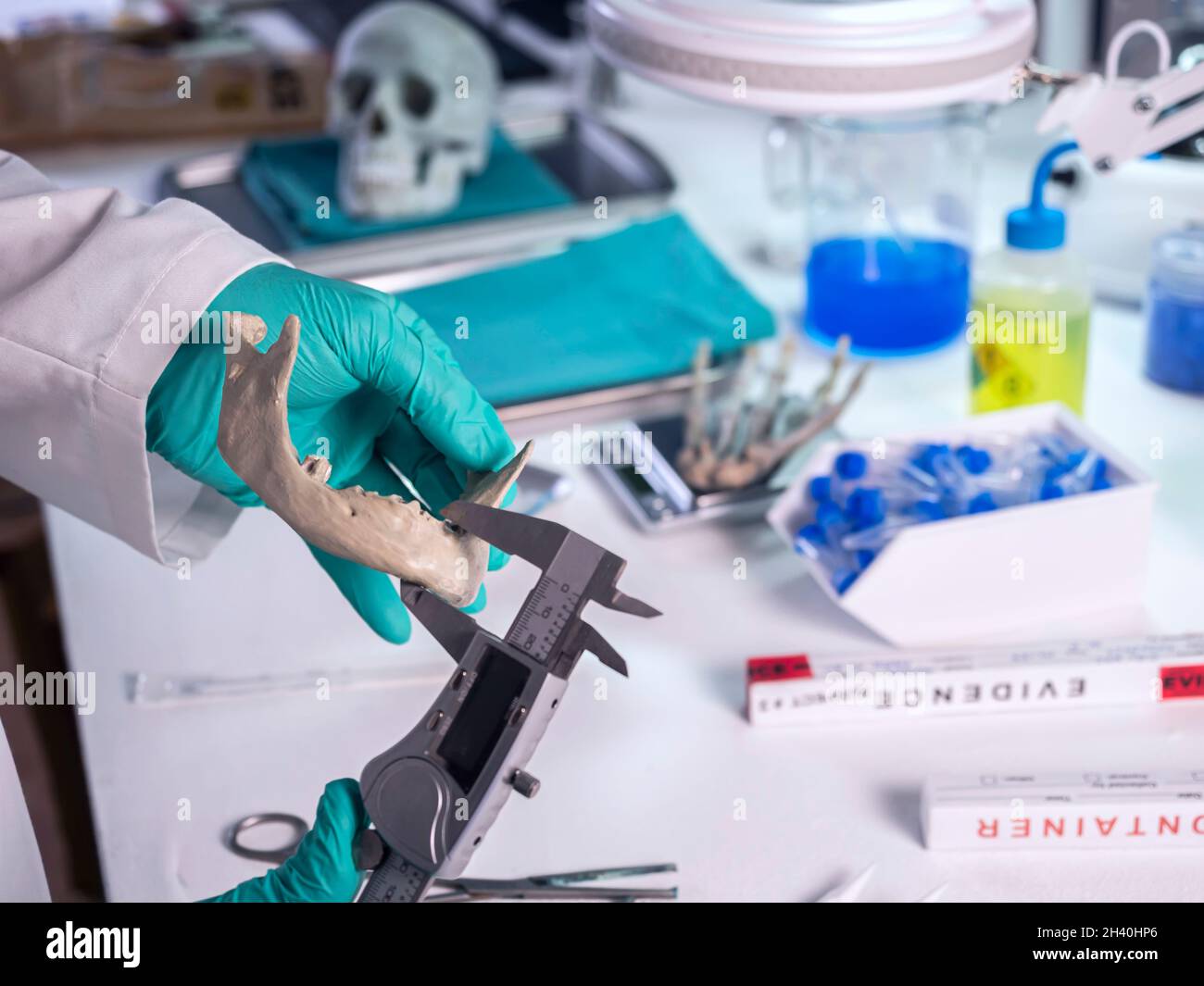 Forensic scientist measures width of lower jaw of murdered adult in crime lab, concept image Stock Photo