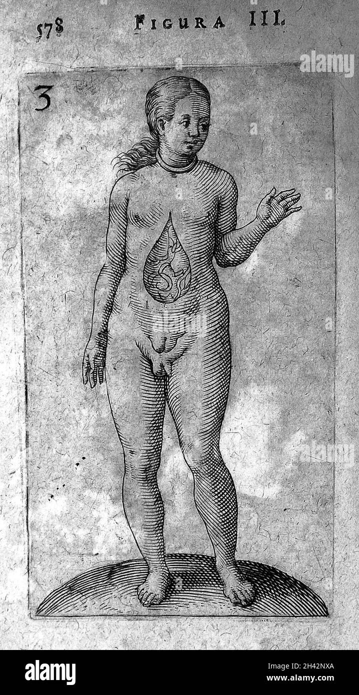 Hermaphrodite from De Hermaphroditorum, 1614 Stock Photo - Alamy