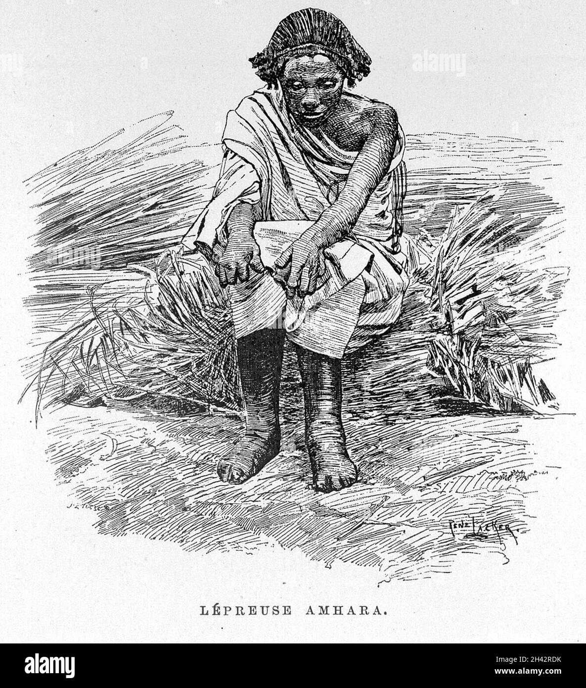 Image of leper in J. Borelli's 'Ethiopie meridionale' Stock Photo