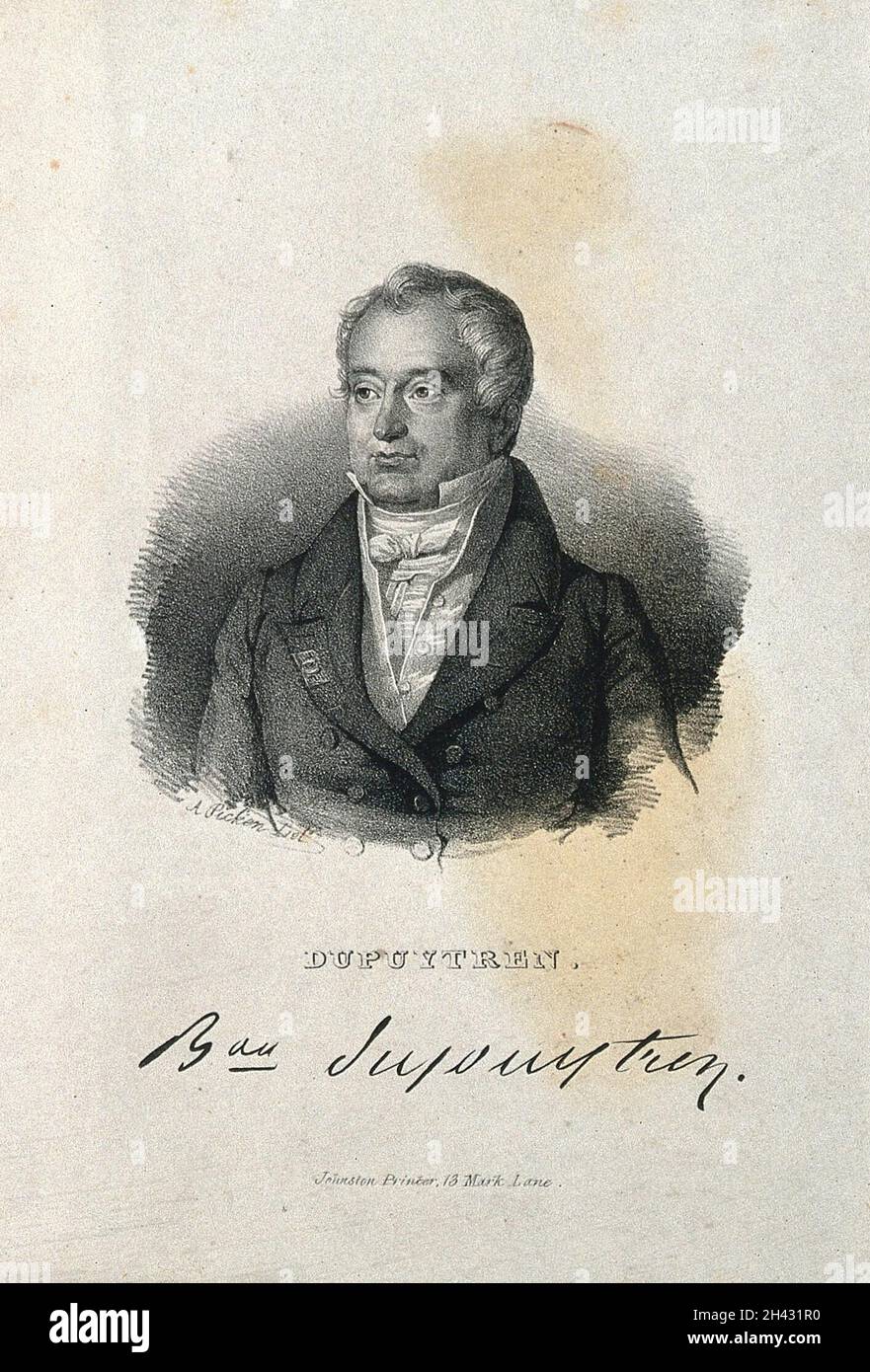 Guillaume Baron Dupuytren Lithograph By A Picken Stock Photo Alamy