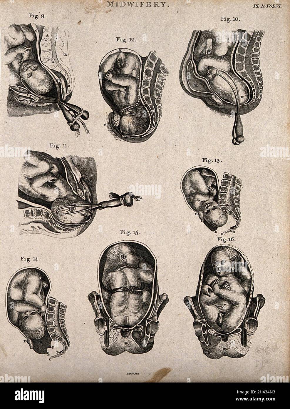 Eight diagrams illustrating babies in the womb in different positions about to enter the world. Etching by Barlow. Stock Photo