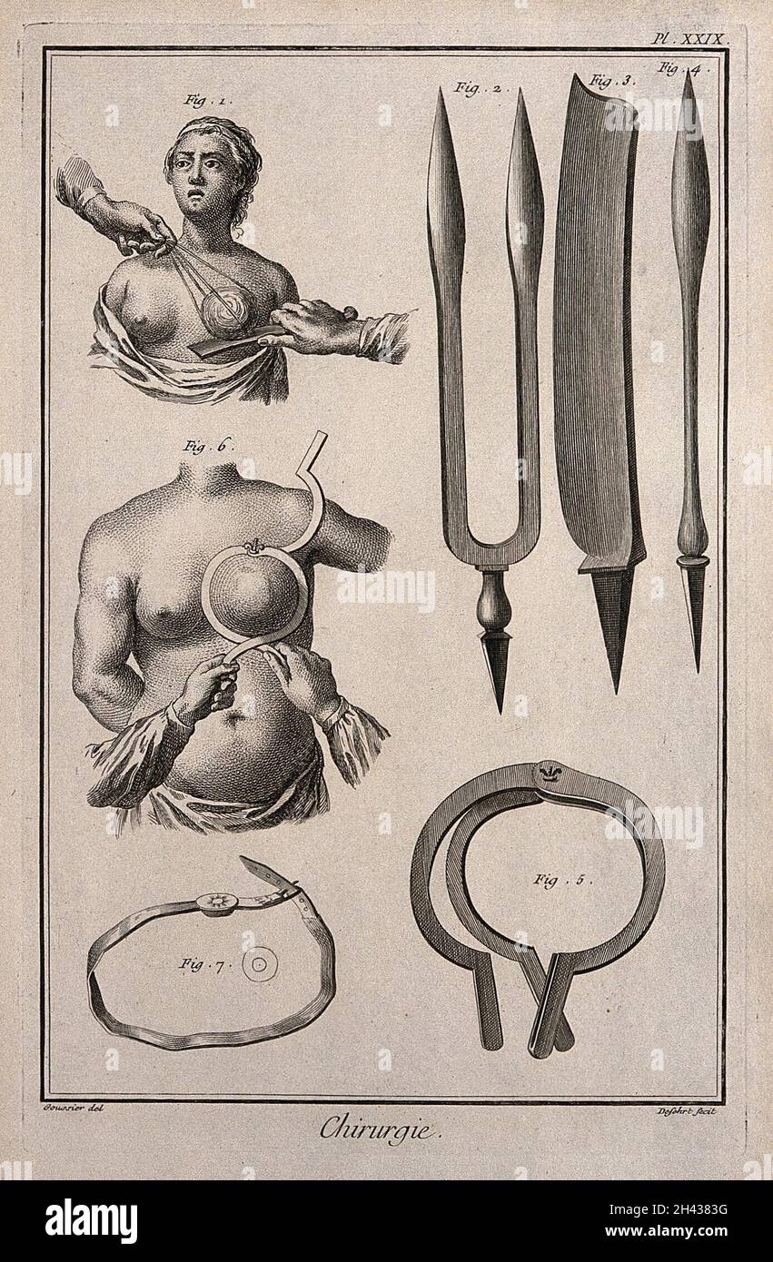 Surgery instruments to perform a mastectomy. Engraving with etching by