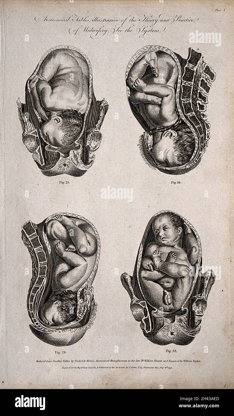 Four babies in different delivery positions in the womb. Engraving by W. Taylor, 1791, after F. Birnie after W. Smellie. Stock Photo