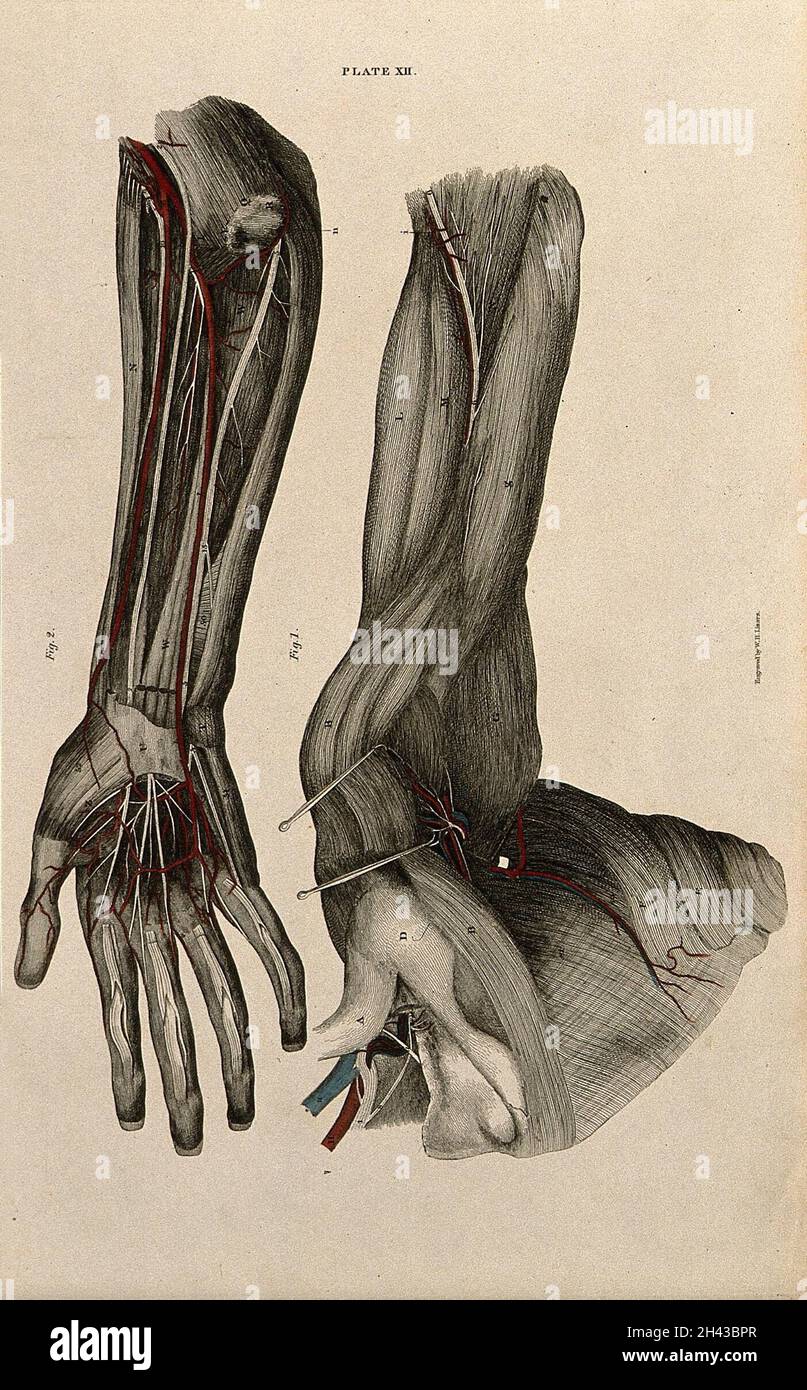 Arm and shoulder: two figures of a dissection, with blood vessels and ...