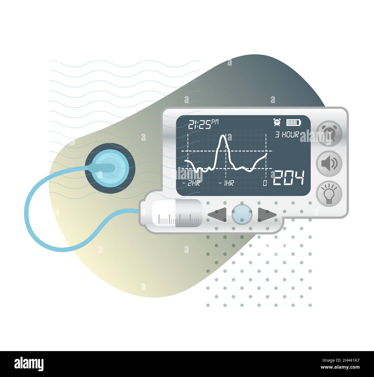 Insulin Pump for Diabetes Stock Illustration as EPS 10 File Stock Vector Image & Art Alamy