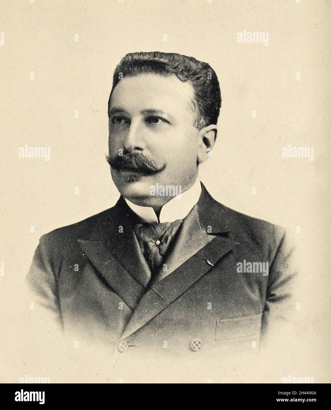 fernand widal hires stock photography and images Alamy