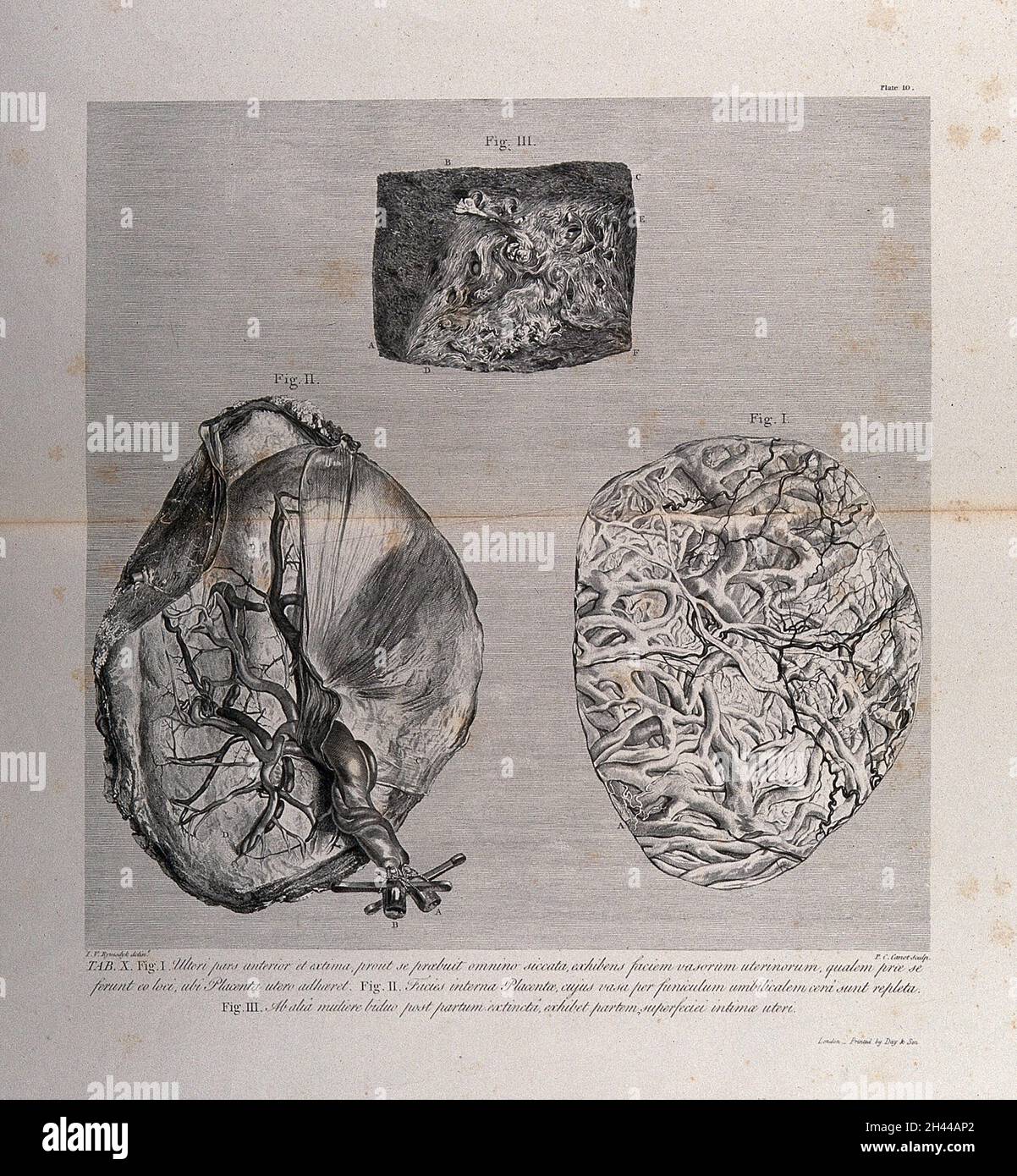 The outer forepart of the uterus, the inside of the placenta and a ...