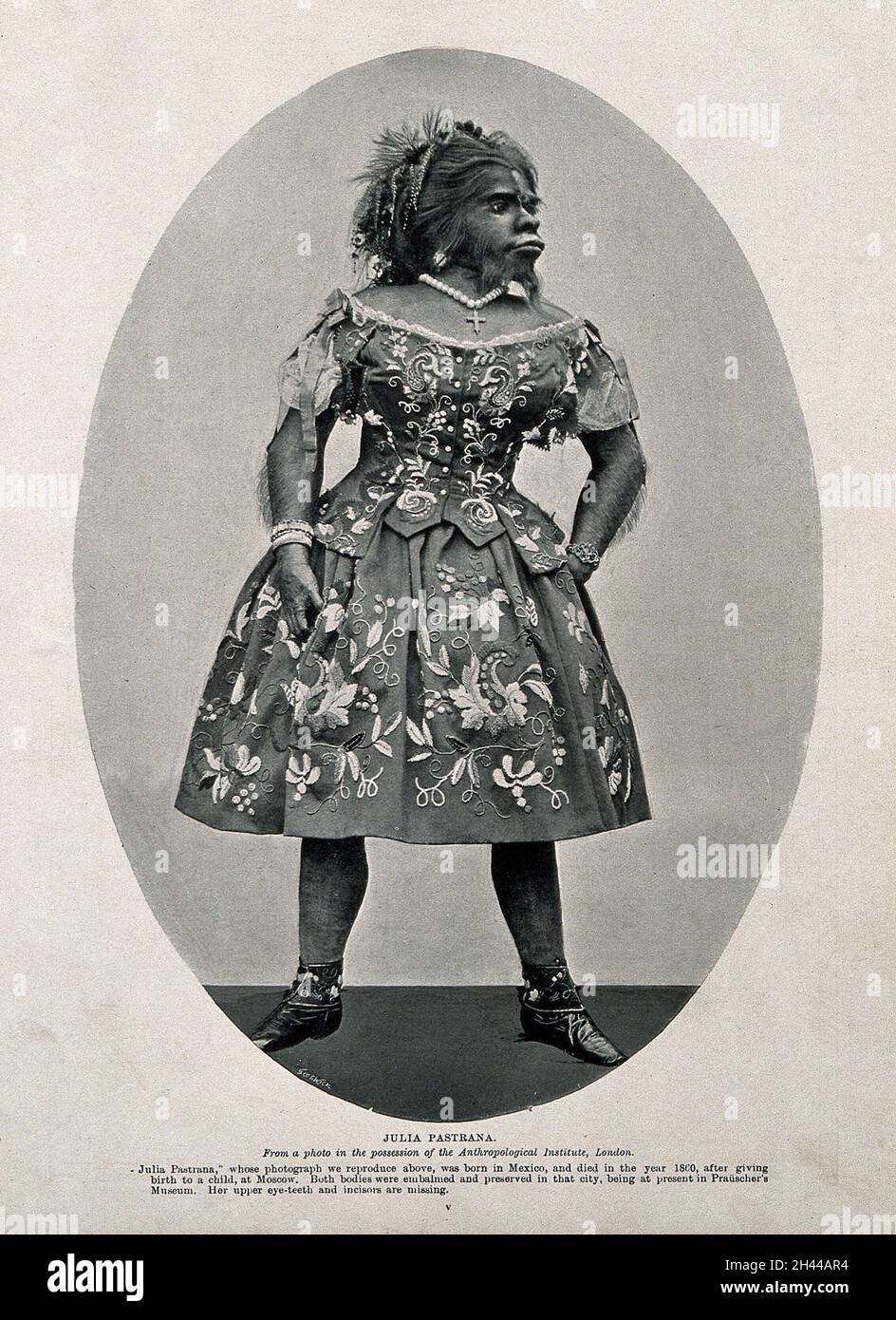 Julia Pastrana, a bearded woman. Process print after G. Wick. Stock Photo
