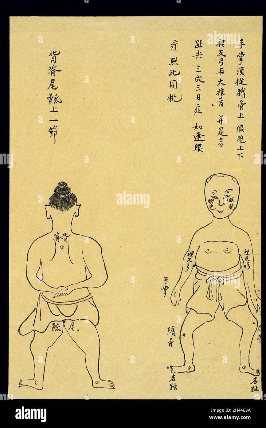 C19 Chinese ink drawing: Location of various boils Stock Photo - Alamy