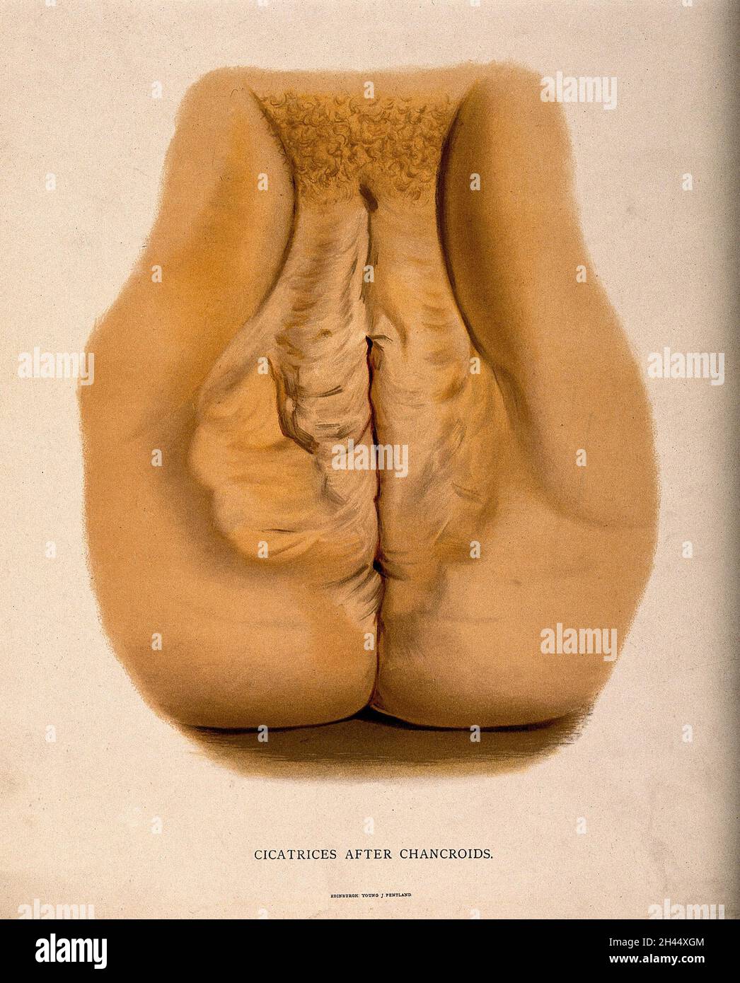 young anus 
