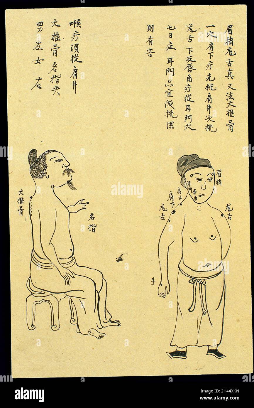 C19 Chinese ink drawing: Location of various boils Stock Photo - Alamy