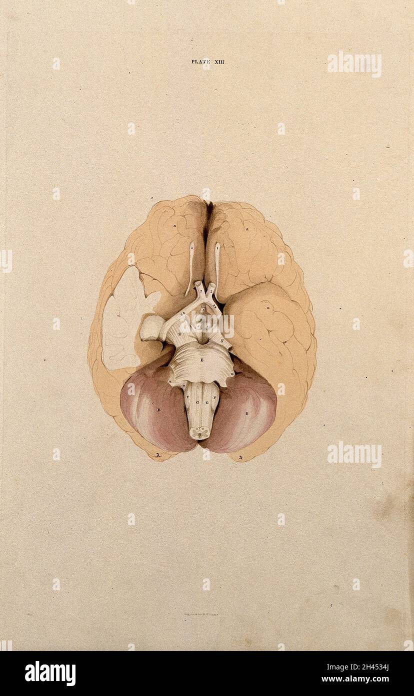 Brain dissection showing the base of the brain. Coloured line