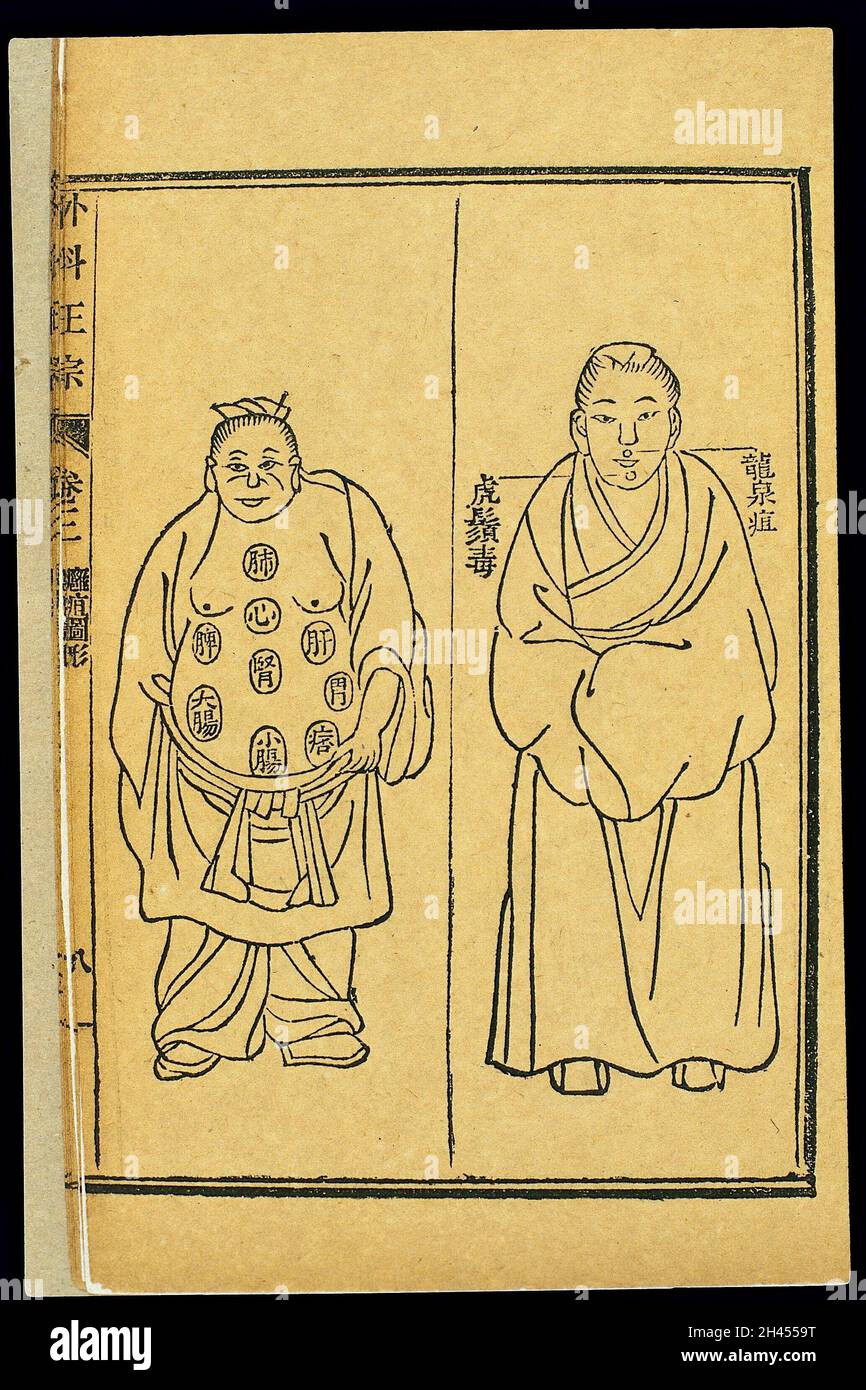 Chinese woodcut Various abscesses and tumours Stock Photo Alamy