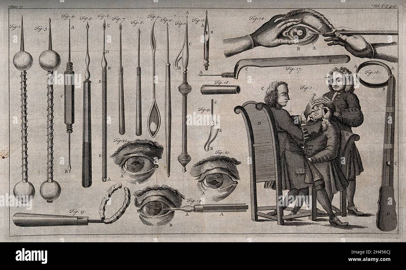 Surgical instruments. Engraving with etching Stock Photo Alamy