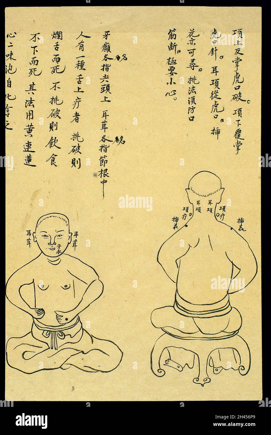 C19 Chinese ink drawing: Location of various boils Stock Photo - Alamy