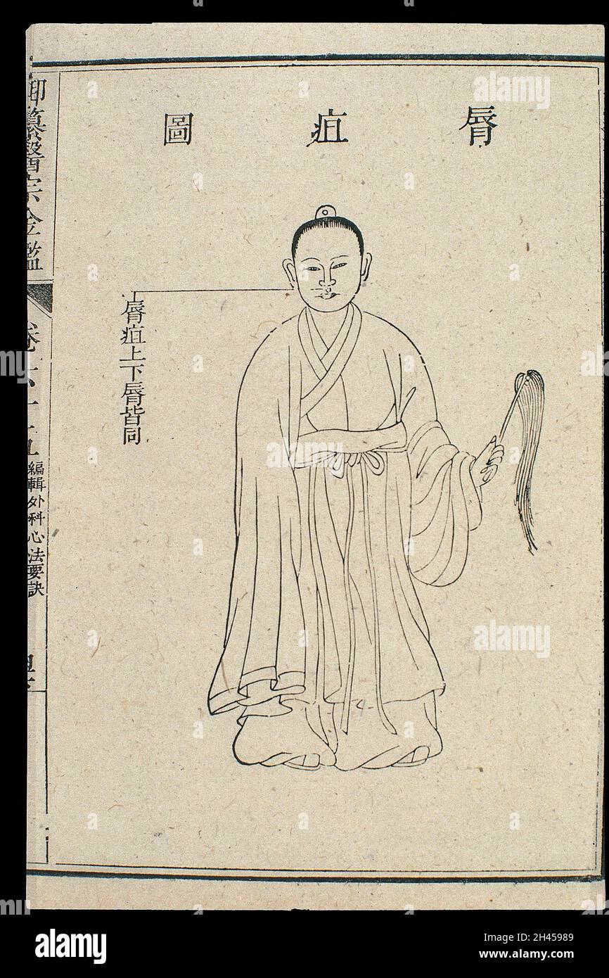 Chinese C18 woodcut The mouth abscesses on the lips Stock Photo Alamy
