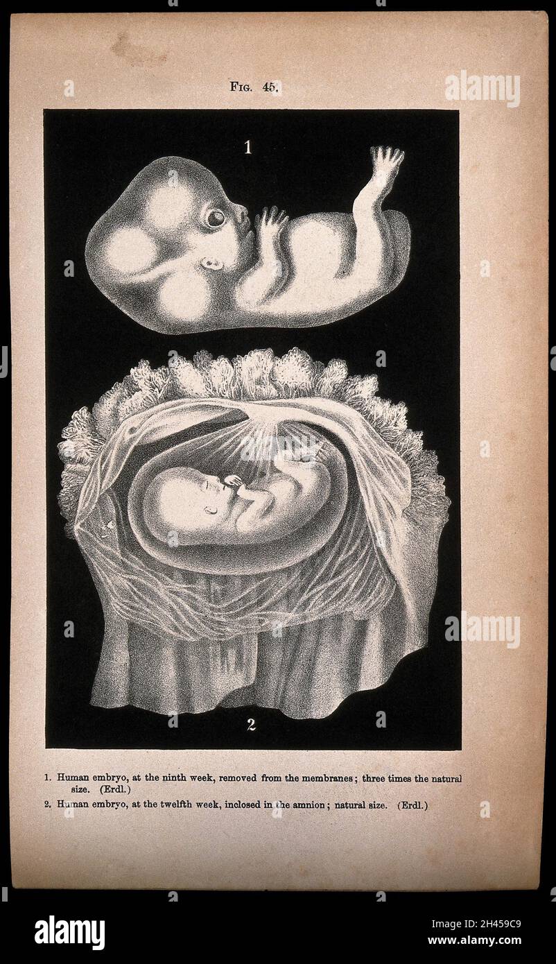 Human embryo, two figures: above, the foetus at nine weeks, below, the foetus at twelve weeks, shown enclosed in the amnion. Lithograph after Erdl, 1850/1900? Stock Photo