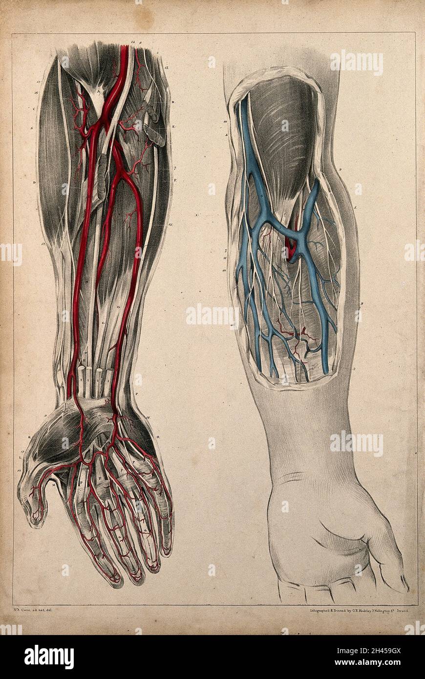 Brachialis Tendon Pain At Crease of Elbow - TitaniumPhysique, image size:870x1390