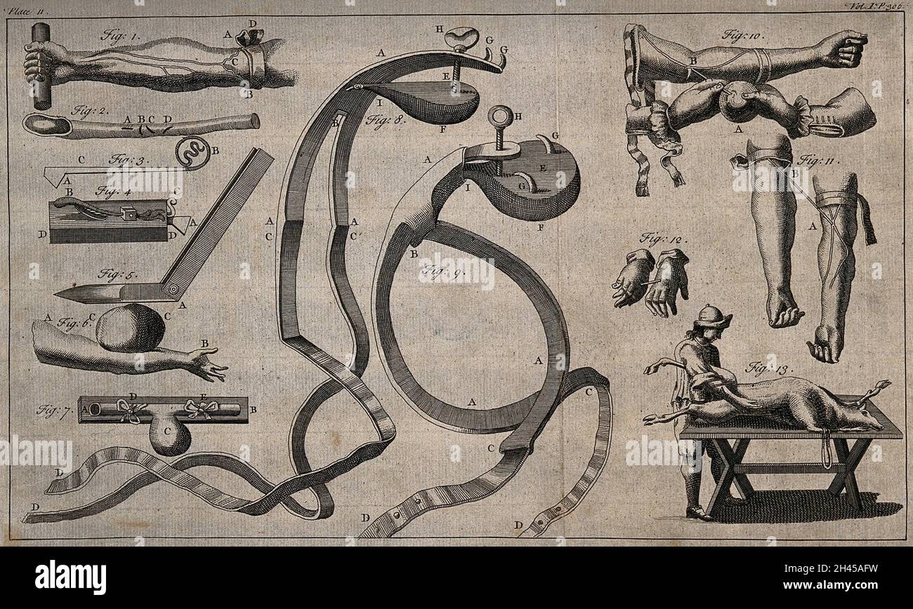 Surgical instruments. Engraving with etching Stock Photo Alamy