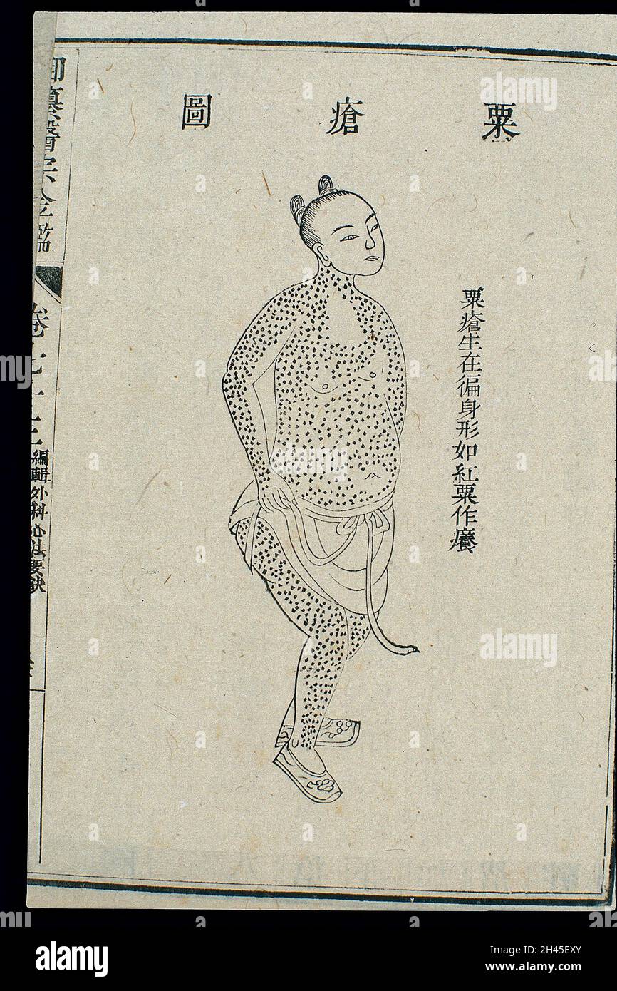 Chinese C18 woodcut External medicine 'Millet rash' Stock Photo Alamy