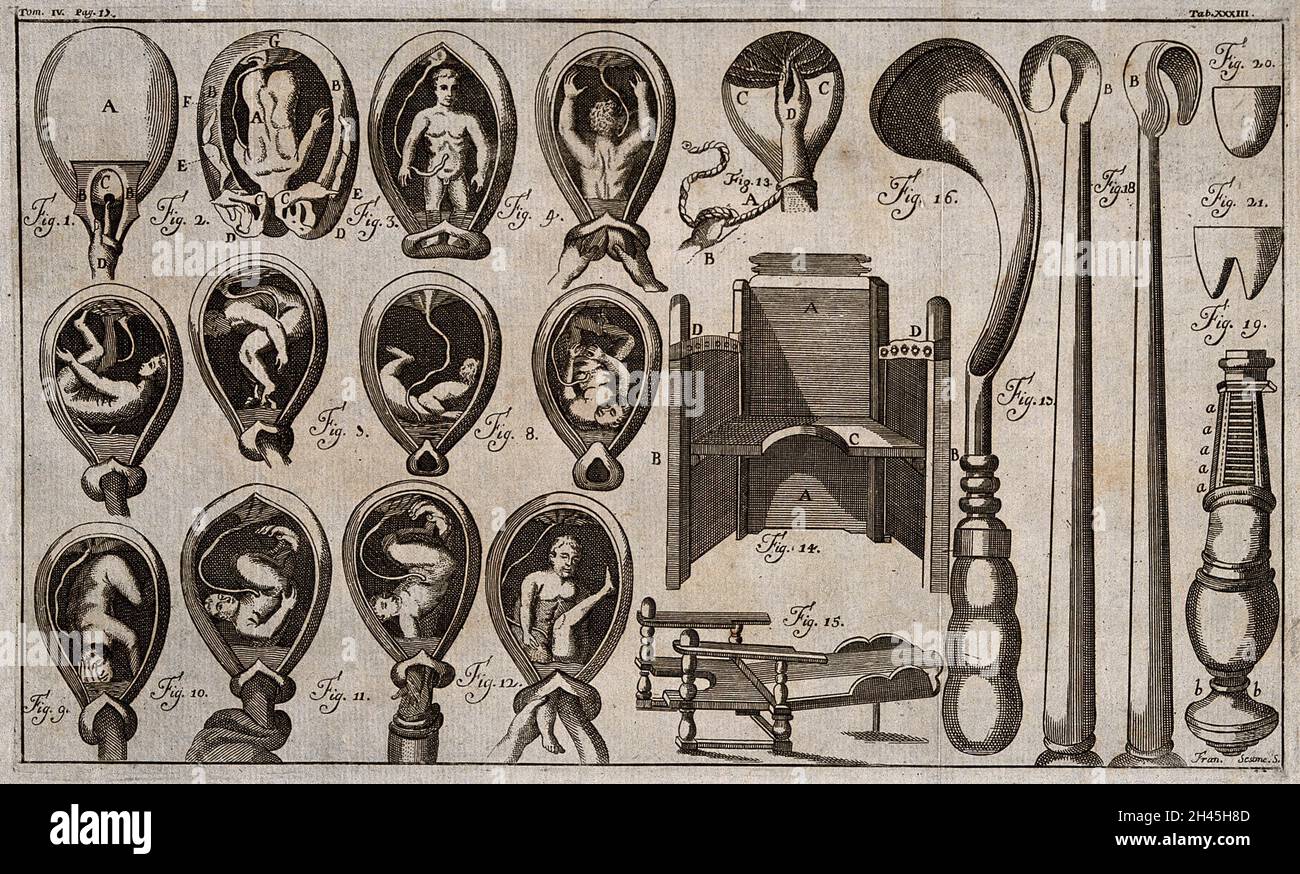 Thirteen diagrams of a child in the womb in various positions; two obstetrical chairs and several obstetrical instruments. Etching by F. Sesone, 1749, after L. Heister. Stock Photo